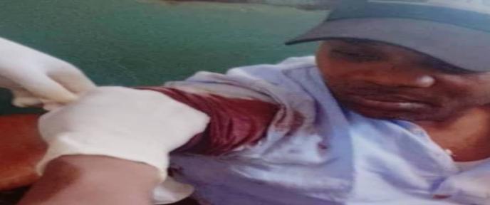 OLPA exige une enquête après blessure par balle d’un journaliste à Durba